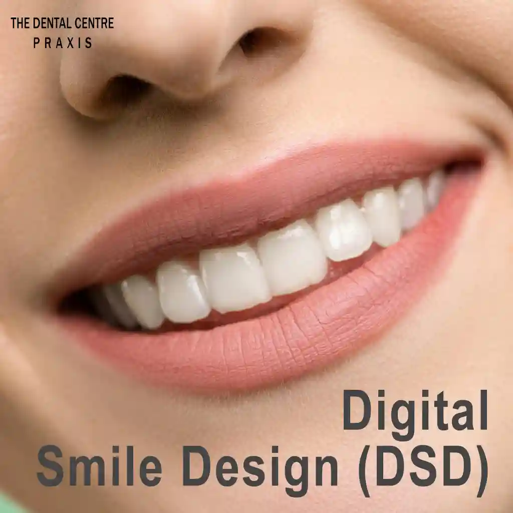 Best Smile Design and Smile Makeover in Mumbai India by Dr Varun Malhotra PRAXIS Dental