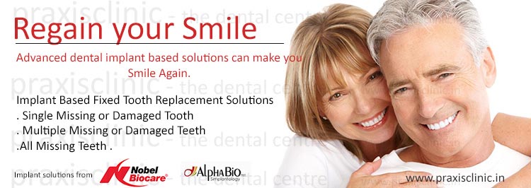 Best Dental Implants in Mumbai, India 