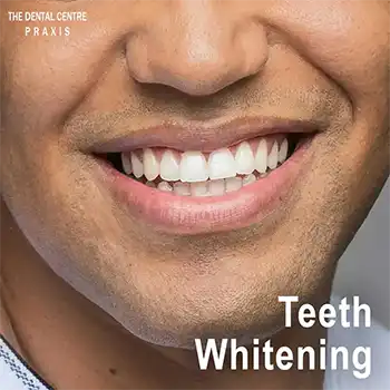 Teeth Whitening by Cosmetic Dentist in Mumbai Dr. Rupali Shah Malhotra ( Cosmetic Dentist ), at The Dental Centre PRAXIS, Mumbai, India